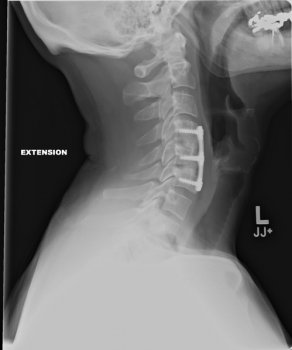 NECK X RAY.jpg